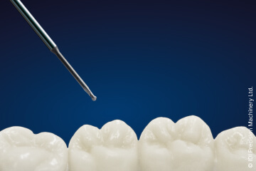 Harte Diamantschichten von CemeCon schlagen die Brücke in den wachsenden Dentalmarkt